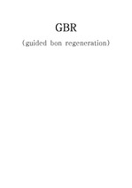 GBR (guided bon regeneration) 골유도재생술