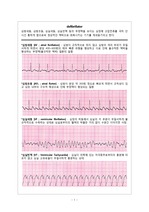 [Defibrillator] cardioversion vs defibrillation