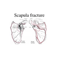 간호과정) 견갑골 골절 case study,scapular  fracture case study