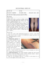 하지정맥류 case/ Critical Reflective Inquiry포함/ A+케이스스터디