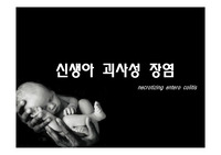 신생아괴사성장염