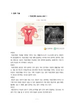 여성간호학 case/자궁근종/수술부터 진단, 약물 정보, 검사까지/