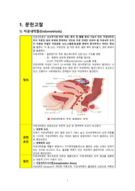 [인기자료]자궁내막증(endometriosis) case study