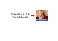 갑상선질환의 모든것