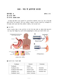ESD, ERCP, EGD 내시경 검사실 견학보고서!!! 검사 목적, 절차, 검사 전후 간호, reference 모두 포함