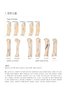 OS정형외과 케이스스터디-골절fracture