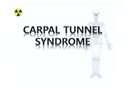 Carpal Tunnel Syndrome 저널 및 환자 케이스
