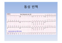 심전도 레포트 심전도 레포트