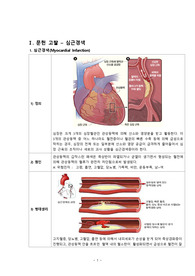 ER case report 심근경색(MI) 문헌고찰 - ER Case / 응급실실습 / 간호학과/ (AAA+++)