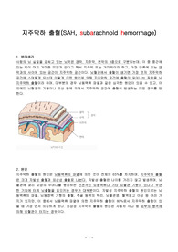 SAH 케이스(지주막하 출혈)