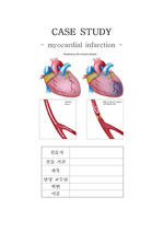 심근경색(MI)Myocardial Infarction CASE STUDY 사례연구, 간호과정, 간호진단