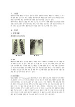 [아동간호학케이스] 폐렴아동간호과정케이스