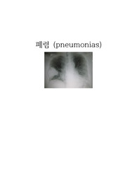 폐렴 케이스 스터디