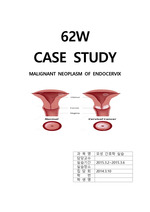 MALIGNANT NEOPLASM OF ENDOCERVIX, case, 자궁경부암케이스, 자궁경부암사례보고서, 자궁경부암간호과정, 간호과정
