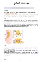 Spinal stenosis Case study (척추관 협착증) OS 간호실습