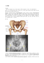 고관절골절 과 인공관절 치환술 수술간호