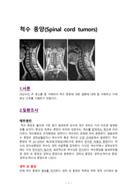 척수종양 케이스스터디