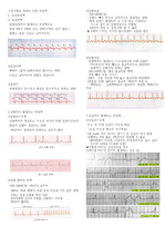 성인간호학 부정맥 정리