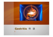 위염(gastritis) ppt