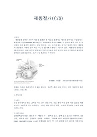 [모성간호] 제왕절개 c/s 요약입니다. (정의/수술준비사항/방법/주의사항/합병증/부작용/식이/ 제왕절개 간호방법)