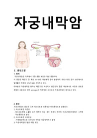 자궁내막암