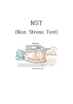NST (Non Stress Test)
