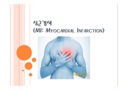 심근경색(MI: Myocardial Infarction)