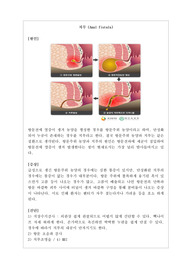 [간호] 치루(anal fistula) 문헌고찰