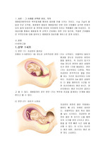 [산과 케이스] 제왕절개 C/S 케이스