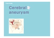 뇌동맥류, Cerebral aneurysm