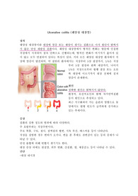 성인간호실습 궤양성 대장암 문헌고찰