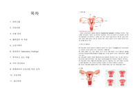 자궁근종(uterine myoma) 케이스 스터디