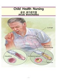 아동간호학 급성세기관지염 AcuteBronchiolitis
