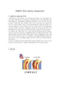 대동맥박리 Case Study