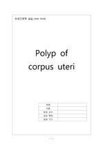 자궁내막폴립, polyp of corpus uteri