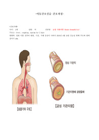 아동 급성기관지염(Acute bronchitis) 간호과정 케이스자료 A++