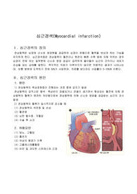 MI 심근경색 문헌고찰