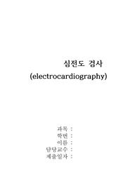 심전도검사