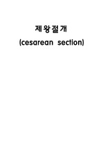 A+자료 케이스스터디(case study) -  여성실습 - 제왕절개(c-sec) - 분만실, 산과 *교수님  피드백 완료*