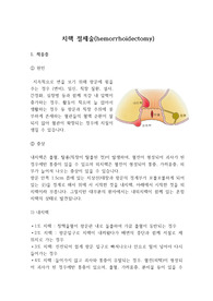 치핵 절제술, hemorrhoidectomy