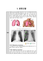 Pnemothorax, 기흉 case study