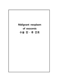 자궁경부암 케이스 스터디