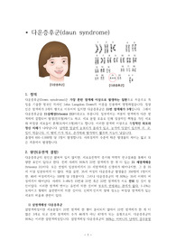 A+받은 아동간호학 다운증후군 문헌고찰, daun syndrome