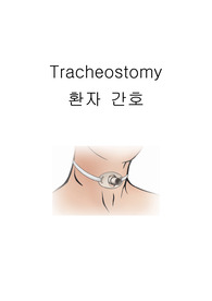 기관절개환자의 간호