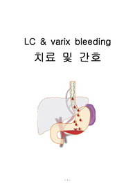 LC, varix bleeding