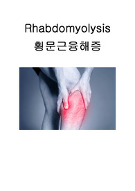 rhabdomyolysis 횡문근융해증