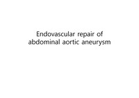 Endovascular repair of abdominal aortic aneurysm