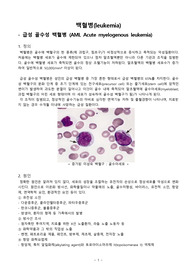 급성 골수성 백혈병(AML)