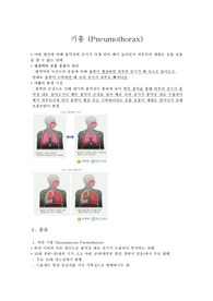 기흉 (Pnemothroax) 자료정리