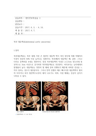 복부대동맥류 케이스